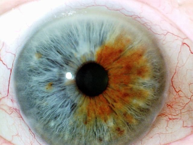 MAIKONG IRIDOLOGY CAMERA 603