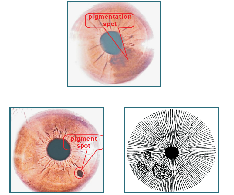 6.3 Pigment spot 002