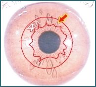 Ilustração da Iridologia – 3.4 Órgãos Internos