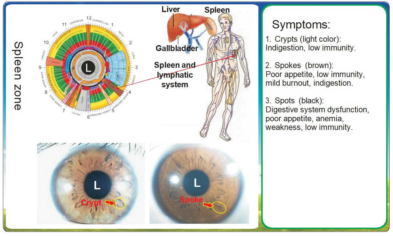 8.1 Iridologia – Zona do Baço: Interpretação de Sinais Irídicos para Saúde Digestiva e Imunológica