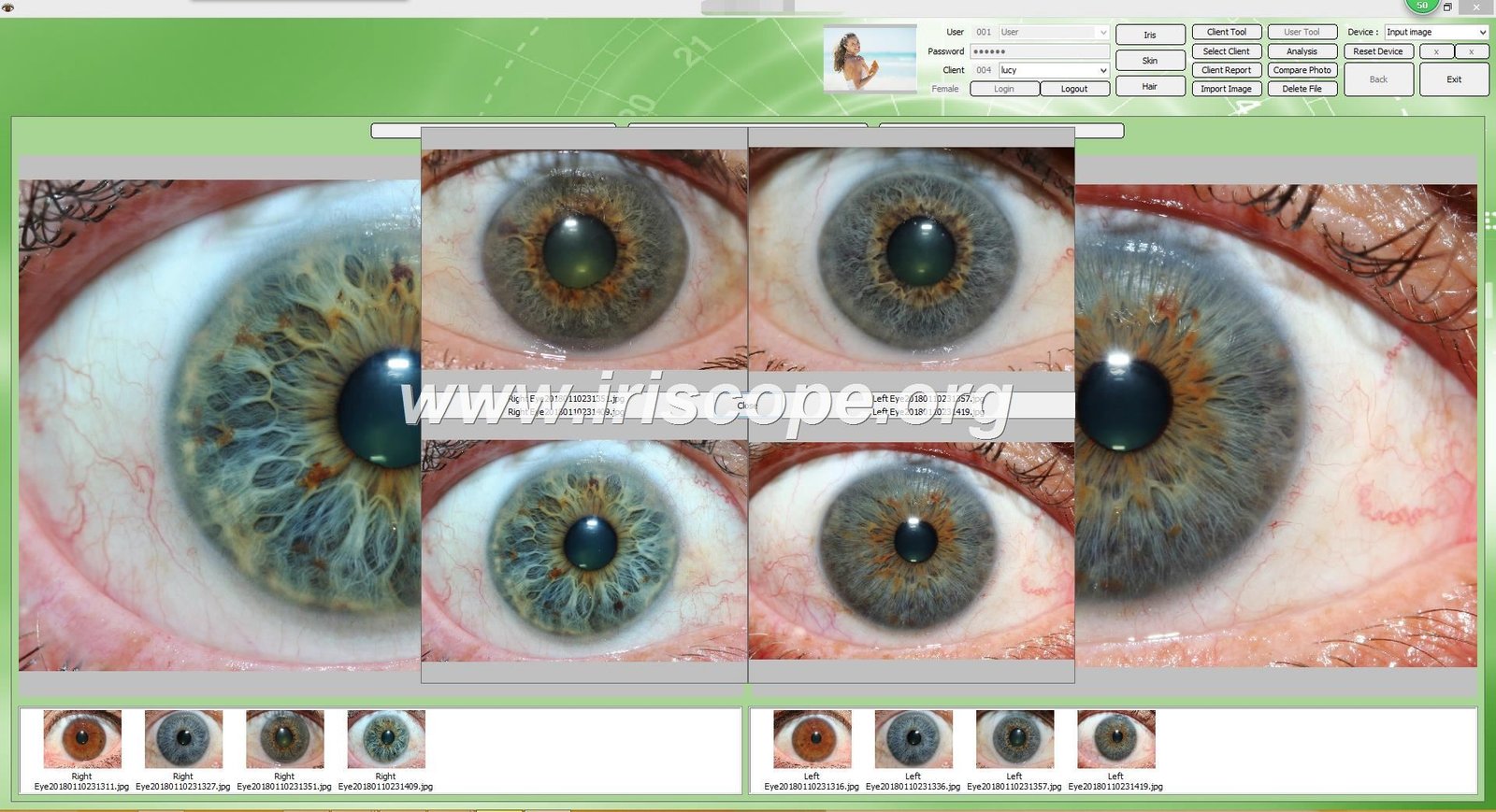 Como escolher um fornecedor confiável de equipamentos de iridologia para atacado em Portugal 3 Como escolher um fornecedor confiável de equipamentos de iridologia para atacado em Portugal — Software de Iridología (33).JPG