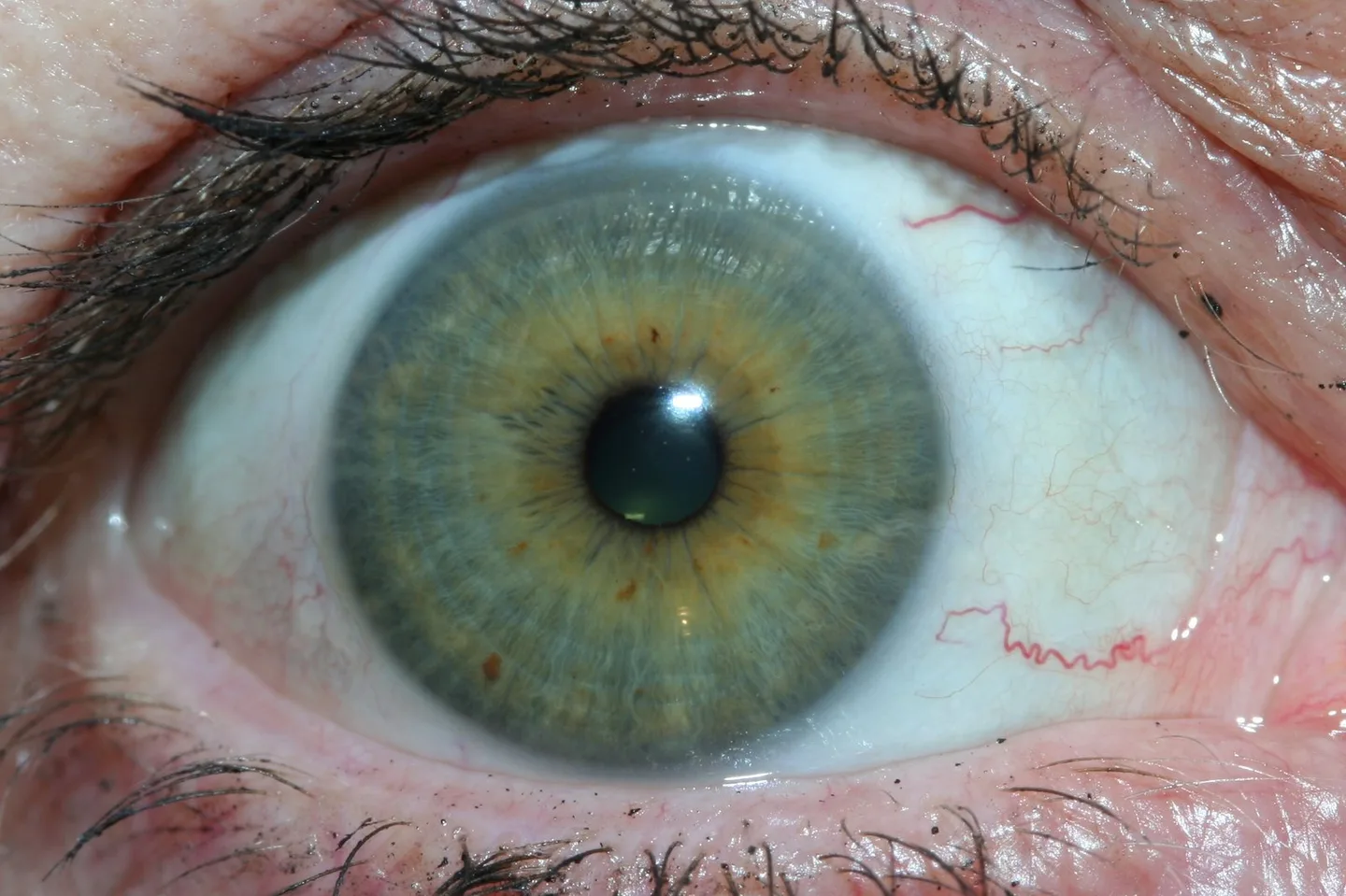 Onde podem comprar equipamentos de iridologia os distribuidores e parceiros em Portugal — iridology eys images 5.jpg