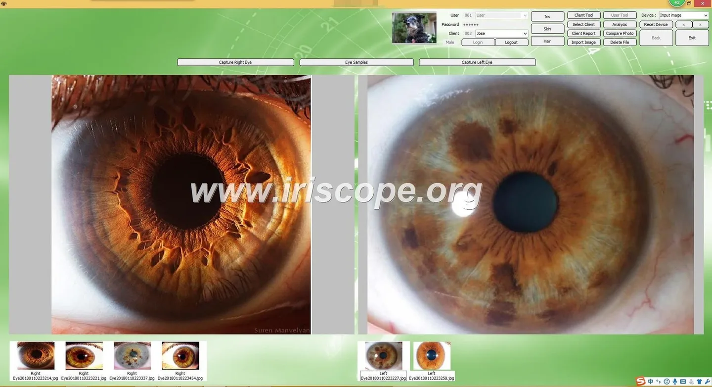 Onde podem comprar equipamentos de iridologia os distribuidores e parceiros em Portugal — Software de Iridología (55).JPG