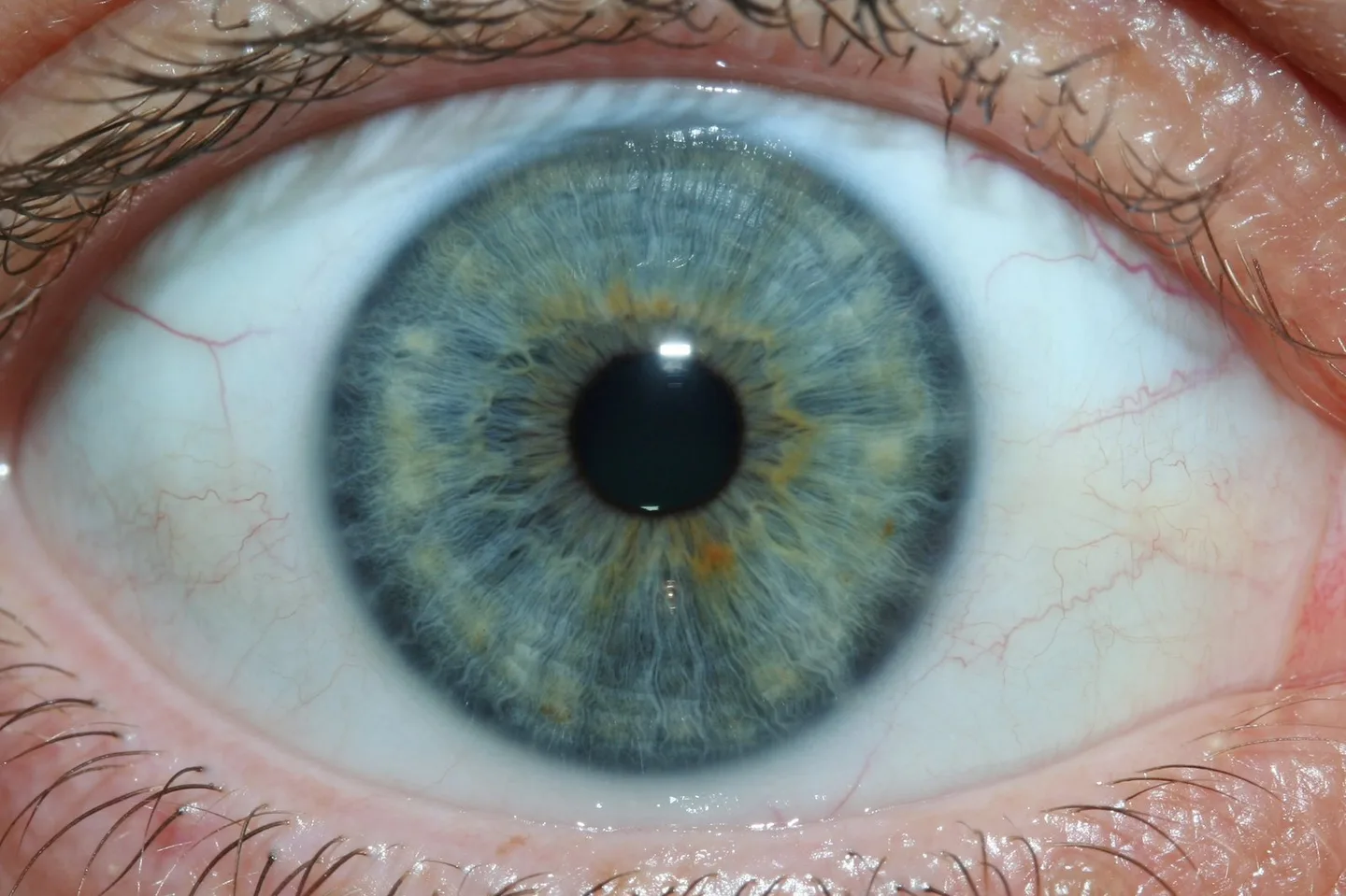 Onde podem comprar equipamentos de iridologia os distribuidores e parceiros em Portugal — iridology eys images 3.jpg