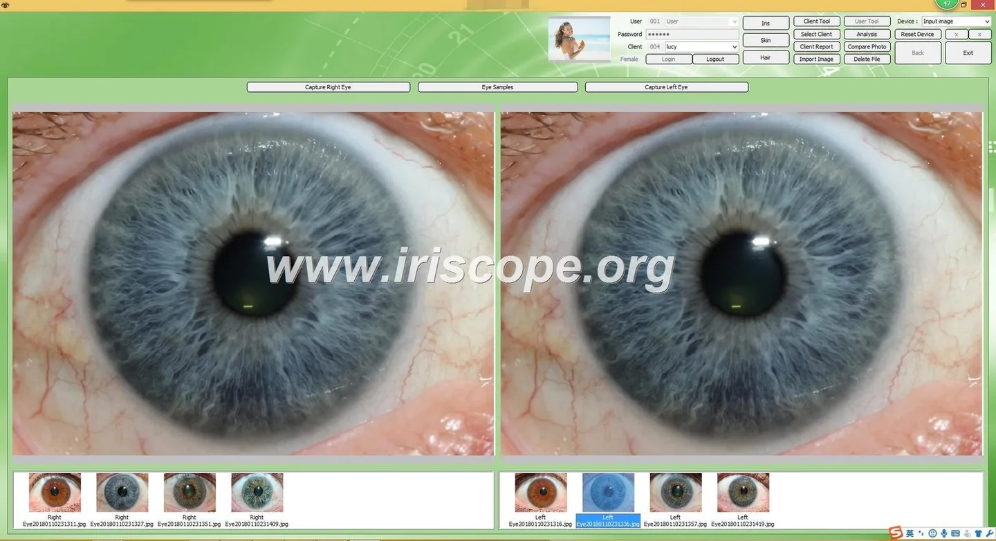 Onde comprar iriscópios e câmaras de iridologia profissionais em Portugal 5 Onde comprar iriscópios e câmaras de iridologia profissionais em Portugal — 030.JPG