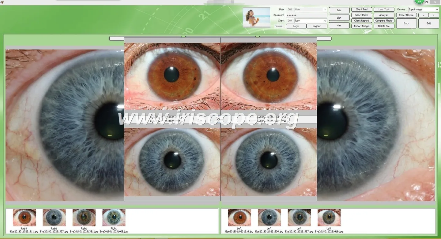 MAIKONG 5MP Iridology camera MK 980U MK 980U 10 MAIKONG 5MP Iridology camera MK 980U MK 980U — 032.JPG