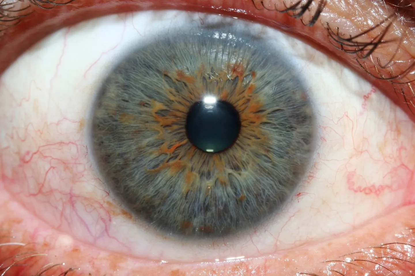MAIKONG 5MP Iridology camera MK 980U MK 980U 12 MAIKONG 5MP Iridology camera MK 980U MK 980U — iridology eys images 1.jpg