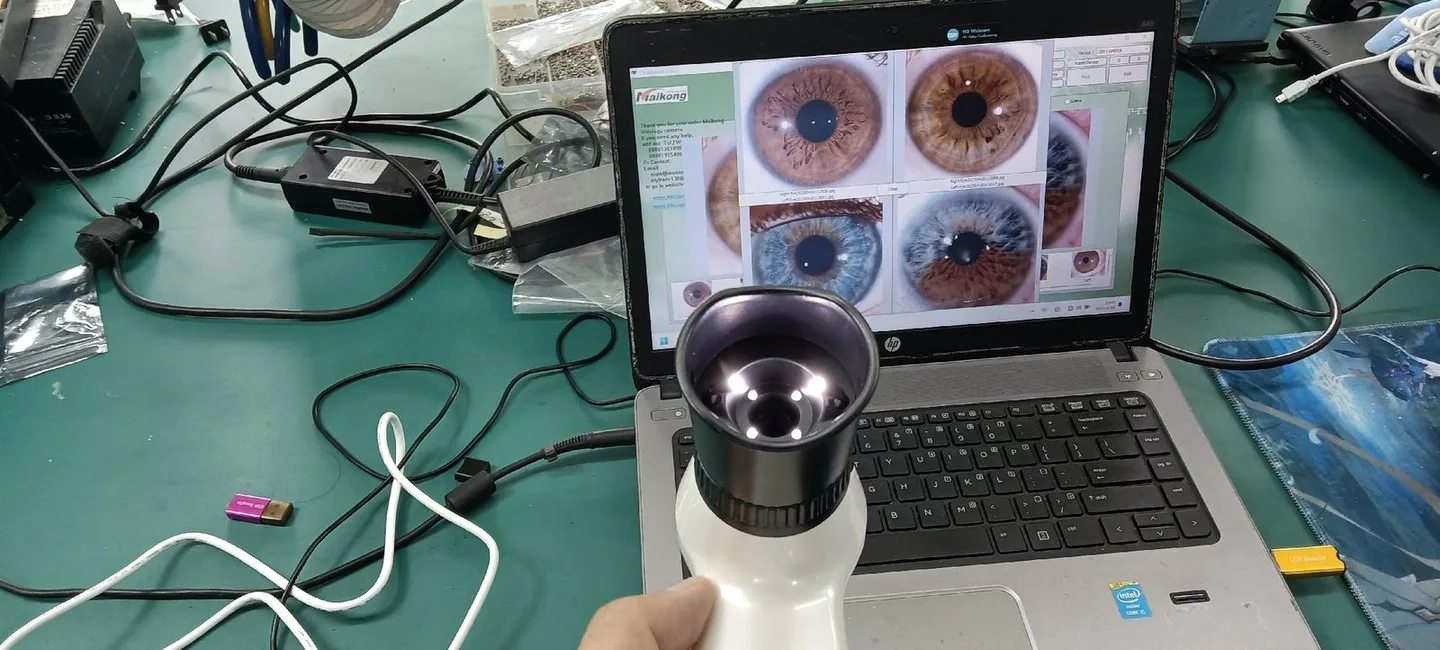 MAIKONG 5MP Iridology camera MK 980U MK 980U 11 MAIKONG 5MP Iridology camera MK 980U MK 980U — 087.JPG