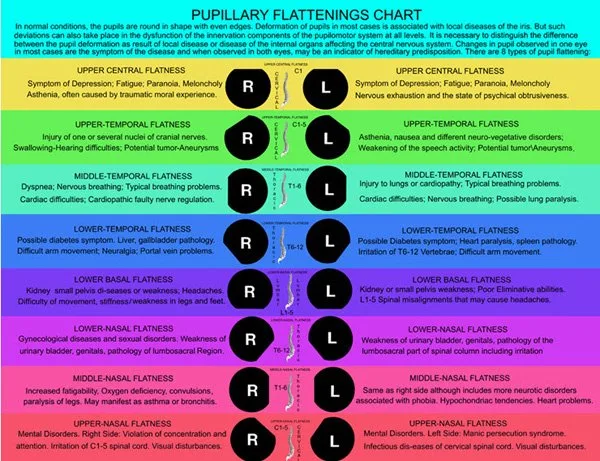 O que compradores e profissionais devem saber ao pesquisar o mapa de iridologia do olho esquerdo 4 O que compradores e profissionais devem saber ao pesquisar o mapa de iridologia do olho esquerdo — PUPILLARY FLATTENINGS CHART1.jpg