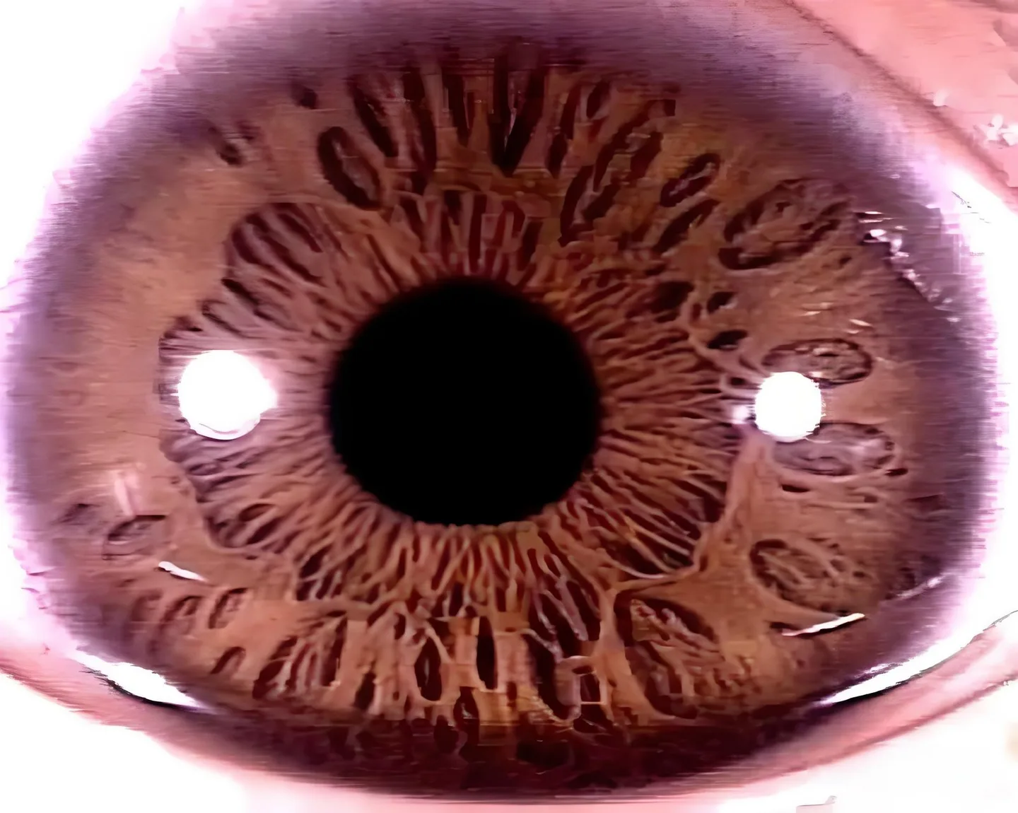 Como integrar software de iridologia em apresentações e aulas em Portugal — Iridology Between Pit iris.jpg