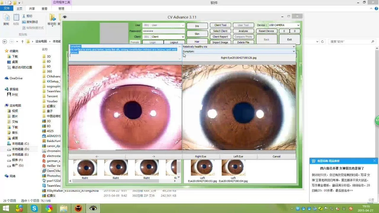Como integrar software de iridologia em apresentações e aulas em Portugal — Camera Iridology iridology software (3).jpg