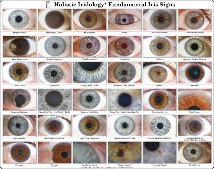 Mapa de iridologia: guia operativo para fornecedores de equipamentos em Portugal — eye-color-charts-iris-eye.jpg