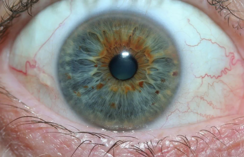 iriscopio — iridology images 26.jpg